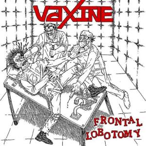 Vaxine frontal lobotomy